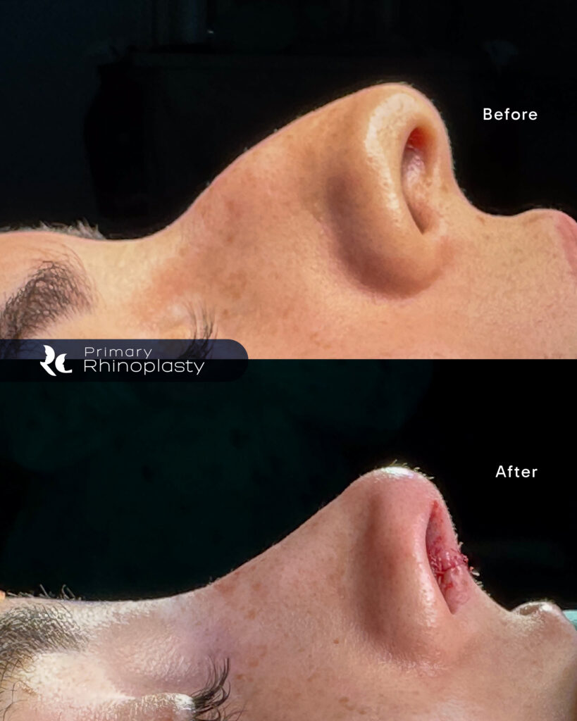 casos Dra Roxana_Mesa de trabajo 1 copia 2